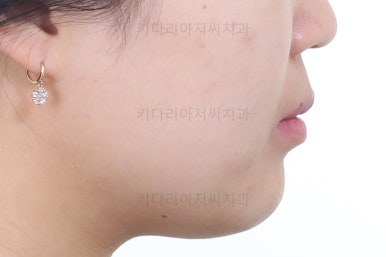 부산치아교정치과