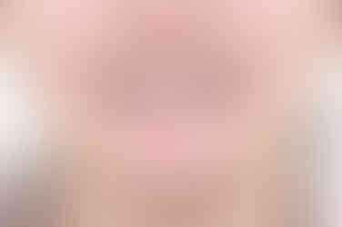 연산동치아교정