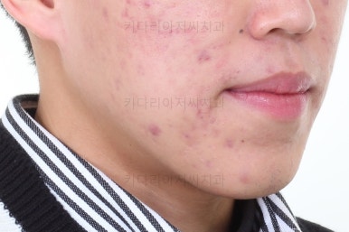 부산교정과전문의