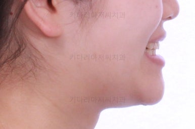 연산동교정치과