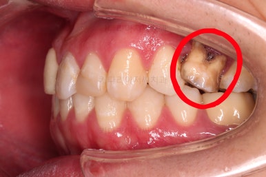 연산동치아교정