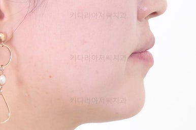 연산동교정치과