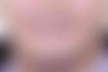 연산동임플란트