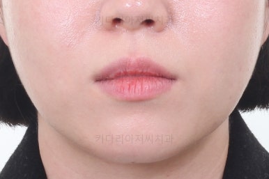 부산치아교정잘하는곳