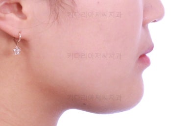 부산치아교정치과