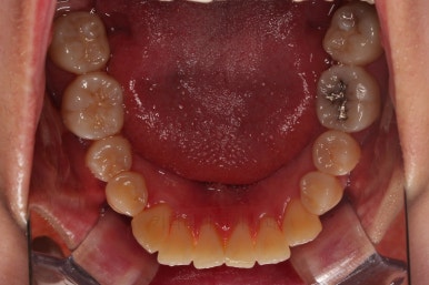 부산치아교정잘하는치과