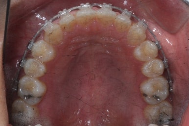 부산치아교정치과