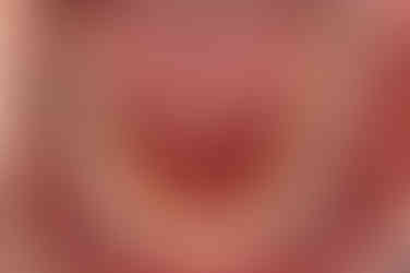 부산치아교정잘하는곳