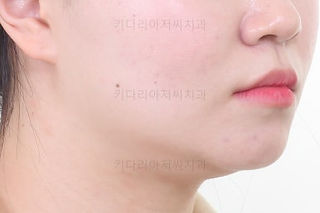 부산교정전문의