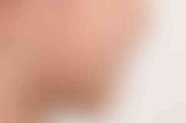 부산어린이반대교합