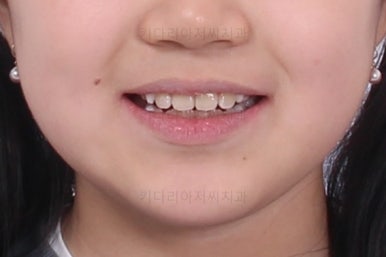 부산초등학생교정