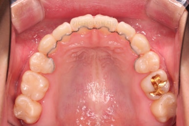 연산동치아교정치과