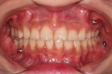 연산동교정치과