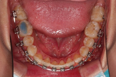 부산치아교정치과