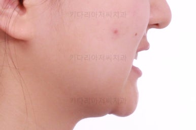 부산청소년교정치과