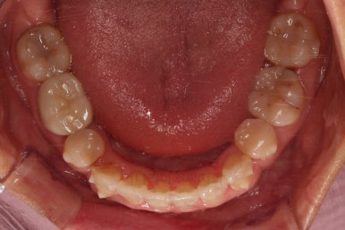 부산인비절라인