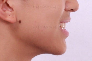 부산교정치과추천