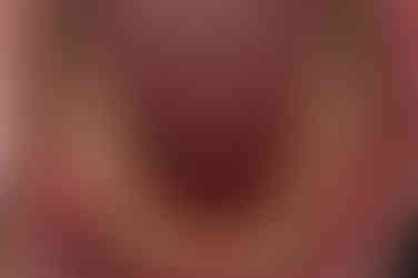 부산교정과전문의