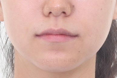 부산교정잘하는치과