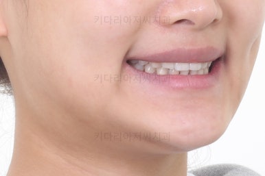 부산교정치과추천
