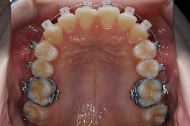 연산동교정치과