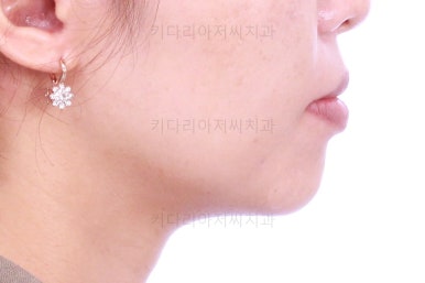 부산연산동교정치과