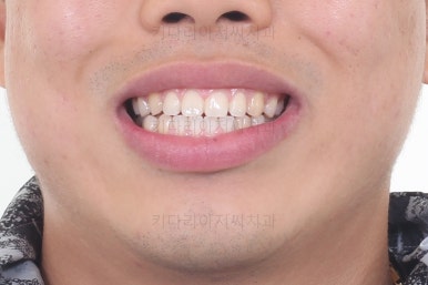 부산교정치과