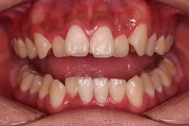 부산치아교정치과