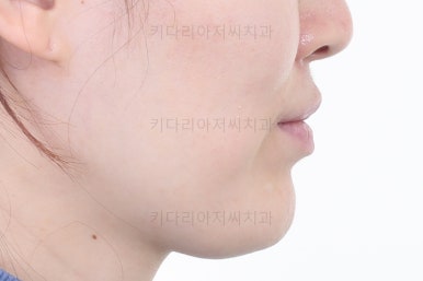 부산교정치과
