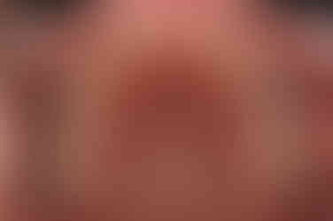 부산연산동교정치과