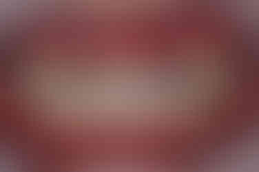 연산동덧니교정