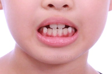 부산어린이교정