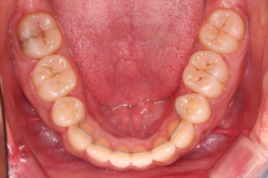 연산동교정치과