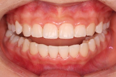 부산치아교정잘하는곳