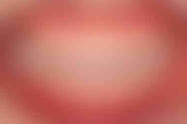 부산치아교정잘하는곳