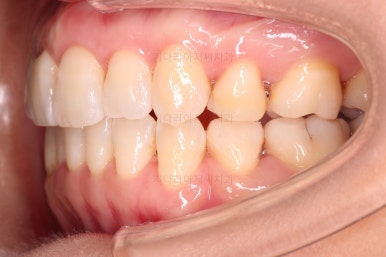 부산인비절라인