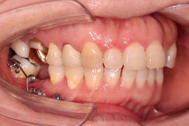 연산동부분교정