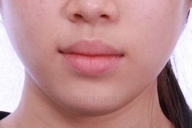 부산치과