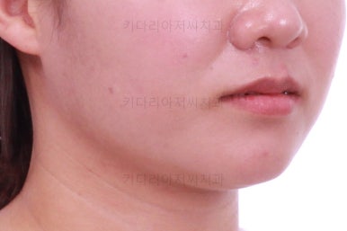 부산치아교정치과