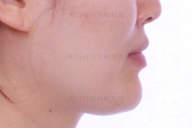 부산교정치과
