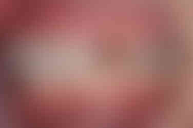 부산매복치아교정