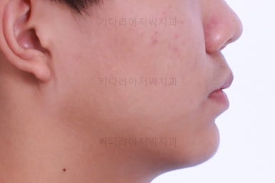 부산청소년교정