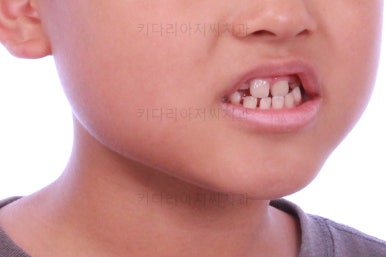 부산어린이교정