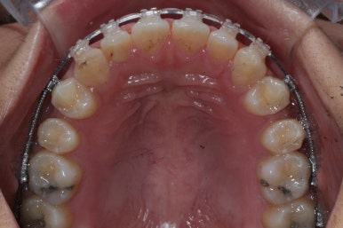 부산치아교정치과