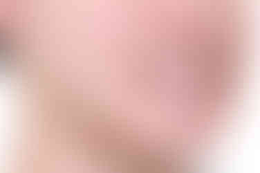 부산주걱턱교정