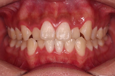 부산치아교정치과