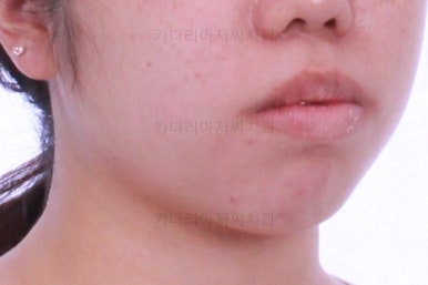 부산교정전문치과