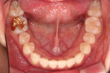 부산인비절라인