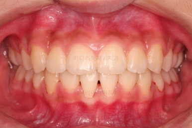 부산치아교정치과