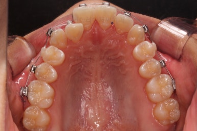 사직동교정치과